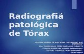 Neumologia - Radiografiá patológica de Tórax.pptx