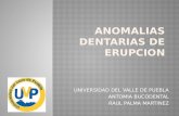 Anomalias Dentarias de Erupcion