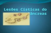 Lesões Císticas do Pâncreas (2)