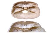 Imagens Reais da base do crânio