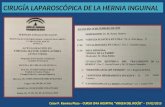 Cirugía Laparoscópica de Hernia en CMA