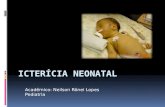 Icterícia Neonatal