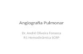 Angiografia Pulmonar