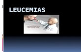 Leucemia - Pediatria