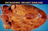 ISCHAEMIC HEART DISEASE. ISCHAEMIC HEART DISEASE (IHD) DOENÇA CARDÍACA ISQUÊMICA A Doença Cardíaca Isquêmica (IHD) é uma condição na qual há distúrbio.