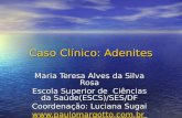 Caso Clínico: Adenites Maria Teresa Alves da Silva Rosa Escola Superior de Ciências da Saúde(ESCS)/SES/DF Coordenação: Luciana Sugai .