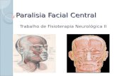 Paralisia Facial Central Trabalho de Fisioterapia Neurológica II.