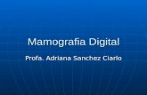 Mamografia Digital Profa. Adriana Sanchez Ciarlo.