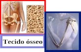 Tecido ósseo. Características Forma especializada de tecido conjuntivo rígido, com matriz mineralizada (calcificada); Possui vascularização, inervação;