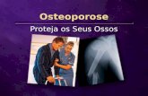 Osteoporose Proteja os Seus Ossos. Uma em cada três mulheres acima dos 50 tem osteoporose.