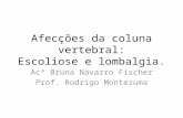 Afecções da coluna vertebral: Escoliose e lombalgia. Acª Bruna Navarro Fischer Prof. Rodrigo Montezuma.