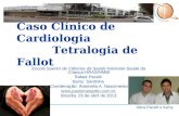 Caso Clínico de Cardiologia Tetralogia de Fallot Escola Suerior de Ciências da Saúde-Internato-Saúde da Criança-HRAS/HMIB Rafael Pacelli Samy Sardinha.