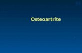 Osteoartrite.. Definição Distúrbio extremamente comum, podendo estar relacionado ao envelhecimento Afeta principalmente mãos, joelhos, quadris e coluna.