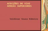 1 AFECÇÕES DE VIAS AÉREAS SUPERIORES Valdinar Sousa Ribeiro.