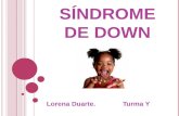 S ÍNDROME DE D OWN Lorena Duarte. Turma Y. H ISTÓRICO : A Síndrome de Down teve suas características descritas em 1866 pelo médico inglês John Langdon.