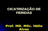 CICATRIZAÇÃO DE FERIDAS Prof. MD. MSc. Hélio Alves.