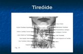 Tireóide. 1 -Tireotoxicose-Hipertireoidismo 2- Hipotireoidismo 3 - Tireoidites 4 - Bócios e Nódulos 5 - Câncer de Tireóide Disfunções tireoidianas.