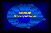 Displasia Broncopulmonar. Introdução  DBP: doença pulmonar crônica mais freqüente em RNPT - BARTON, HODGMAN, PAVLOVA,1999 BARTON, HODGMAN, PAVLOVA,1999.