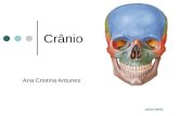 Ana Cristina Antunes Crânio Netter (2003). Generalidades Série de ossos Maioria unidos por articulações imóveis Exceto a mandíbula Articulação Sinovial.