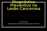 Diagnóstico Preventivo na Lesão Cancerosa José Travassos Valdez Naturólogo, especialista em Fitoterapia espargírica e diagnósticos de prevenção.
