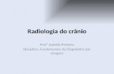 Radiologia do crânio Profª Isabella Pinheiro Disciplina: Fundamentos de Diagnóstico por Imagem.
