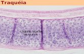 Traquéia CARTILAGEM HIALINA Glândulas da Traquéia: Seromucosas e Serosas.