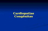 Cardiopatias Congênitas. Anormalidade presentes tanto na estrutura como na função cardiocirculatória, presentes já ao nascimento, mesmo que sejam diagnosticadas.