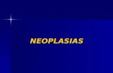 NEOPLASIAS. NEOPLASIA NEOPLASIA = TUMOR NEOPLASIA = TUMOR  BENIGNAS  MALIGNAS (CÂNCER)