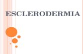 ESCLERODERMIA INTRODUÇÃO O que é? A esclerodermia é uma doença auto-imune crônica e degenerativa que pode ter efeitos localizados na pele ou efeitos.