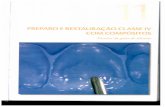 Odontologia Restauradora - Cap. 11 - Classe IV Com Compósitos - Guia de Silicone e Mão Livre