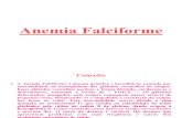 Anemia Falciforme IISLIDES