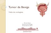 Tumor da Bexiga.pdf