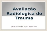 Avaliação radiológica do trauma no sistema músculo esquelético