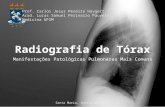 Monitoria Radiografia de Tórax - Manifestações Patológicas Pulmonares
