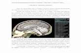Aula Final – Sistema Lí · PDF fileCurso de Neuroanatomia Descritiva e Funcional – Aula Final: O Sistema Límbico 3 O Sistema Límbico está aqui dissecado, mostrando algumas