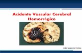 Acidente Vascular Cerebral Hemorrágico · PDF fileClínica Quadro de instalação súbita Cefaleias, vómitos, alt. estado consciência Sintomas neurológicos focais Sintomas e sinais
