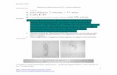 Envelhecimento fisiológico(atrito):Zona hipovascularizada  · PDF fileResumo Sbot     2 Função: flexor do tornozelo e principal