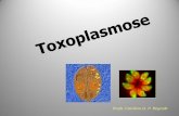 Agente etiológico: Toxoplasma gondii€¦ · Toxoplasmose congênita Somente durante a fase aguda de infecção da infecção materna os parasitas são passados para o feto. Das