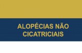 ALOPÉCIAS NÃO CICATRICIAIS - drluizporto.com.brdrluizporto.com.br/wp-content/uploads/2017/03/TRICOLOGIA... · ALOPÉCIA AREATA •Diagnóstico:-Clínica, exame físico e dermatoscopia.-Laboratório: