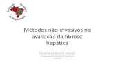 Métodos não-invasivos na avaliação da fibrose hepática€¦ · Oliveira AC, Al Bacha I, Valverde MV, Parise ER, 2014 in preparation N= 785 HCV+ pacientes . ... IMC 2,438 1,098-5,414