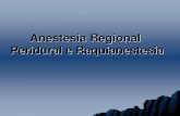 Anestesia Regional Peridural e Raquianestesiaanestesiologia.paginas.ufsc.br/files/2015/06/raquianestesia-e-ana... · Lidocaína 7,9 11 24 44 ... Soluções isobárica hipobárica