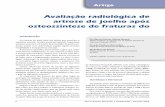 Avaliação radiológica de artrose de joelho após ...bvsms.saude.gov.br/bvs/periodicos/ortotrauma_2005_fev.pdf · 5 Orto & Trauma: Discussões e Complicações • Fevereiro 2005