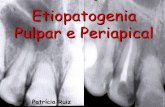 Etiopatogenia Pulpar e Periapical - Patrícia Ruiz Spyere · Hiperemia pulpar 4. da pressão tecidual intersticial 5. Filtração do fluido dentinário para a periferia Desidratação