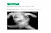 Imagem da Semana: Radiografia - acoesunimedbh.com.br · Considera-se que possa se tratar de um estágio prévio à EHP. Discussão A estenose hipertrófica do piloro (EHP) apresenta
