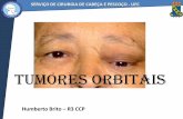 TUMORES ORBITAIS - cirurgiacp.ufc.br Brito 2012... · • Comumente usado para fazer Dx de linfoma, sarcoidose e processos inflamatórios não específicos orbitais Cockerham, 2001