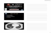 Lesões Cisticas na Tomografia computadorizada - SBPTbkpsbpt.org.br/arquivos/pdf/cnap2016_d22_BrunoHochhegger.pdf · pulmonar com uma interface bem definida com o ... Consenso brasileiro