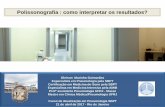 Polissonografia - Sociedade Brasileira de Pneumologia e ...bkpsbpt.org.br/arquivos/pdf/cnap2017_d22_GleisonMarinho.pdf · Estudo de noite inteira no laboratório, sob supervisão