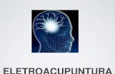 ELETROACUPUNTURA - Portal Unisaúde · como base a Acupuntura e é utilizada do uso de aparelhos el étricos, que conectados as agulhas transmitem est ímulos aos pontos de acupuntura;