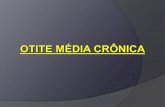 Patologias da Orelha média - files.drresumo.webnode.com.brfiles.drresumo.webnode.com.br/200000450-5d22a5e1c7/Otites Médias... · Otite Média Crônica Timpanoplastia tipo I ...