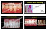 Formas da Doença PeriodontalFormas da Doença Periodontal da Doenca... · conseqqçggçüentemente, à inflamação gengival e a destruição do periodonto. Gibbsons & Socransky